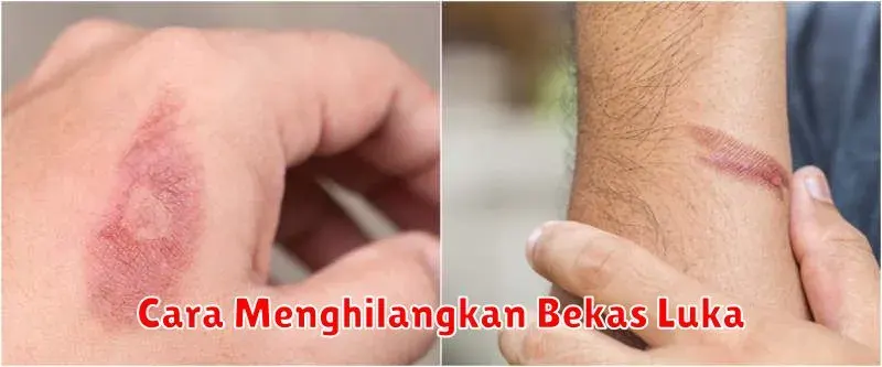 Cara Menghilangkan Bekas Luka: Panduan Lengkap untuk Kulit Sehat dan
Bersih